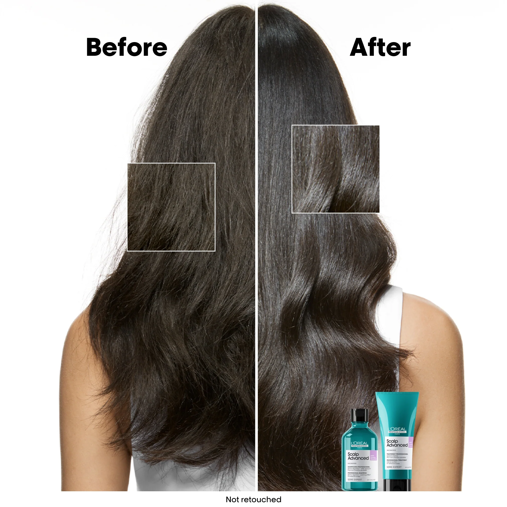 L'Oréal Professionnel Serié Expert Scalp Advanced Anti-Discomfort Dermo-Regulator Shampoo 300ml - Image 3