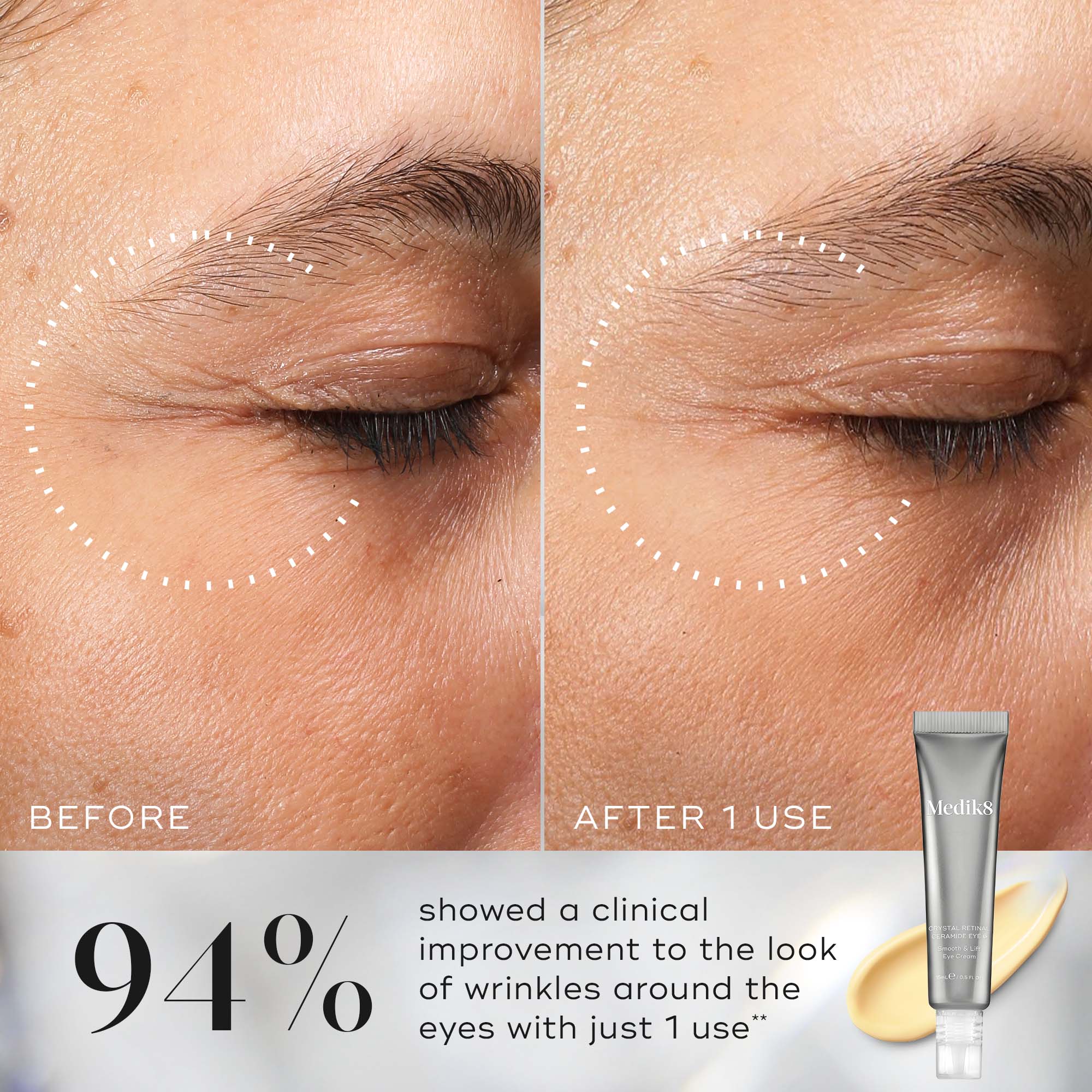 Medik8 Crystal Retinal Ceramide Eye 3 15ml - Image 5